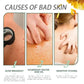 Salicylic Acid Acne Treatment Cream for Pore Care